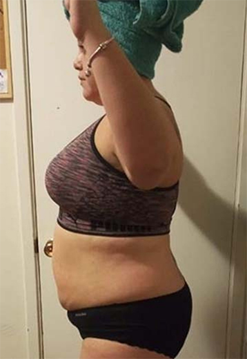 Client after photo