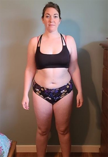 Client before photo